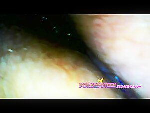 Girl Endoscope Fill up COMPILATION